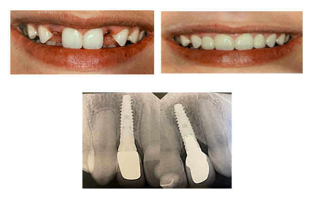 before and after photo