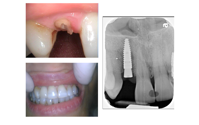 before and after photo