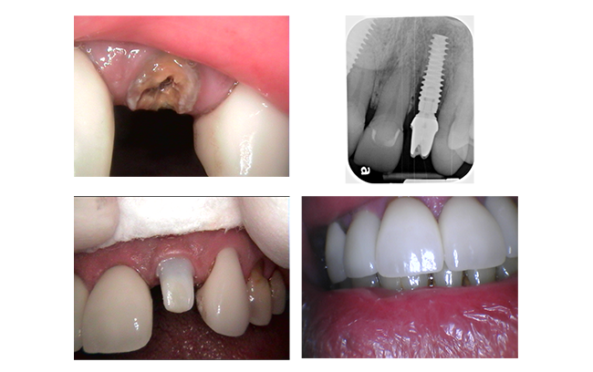 before and after photo