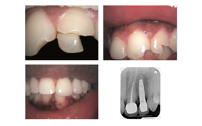 before and after photo